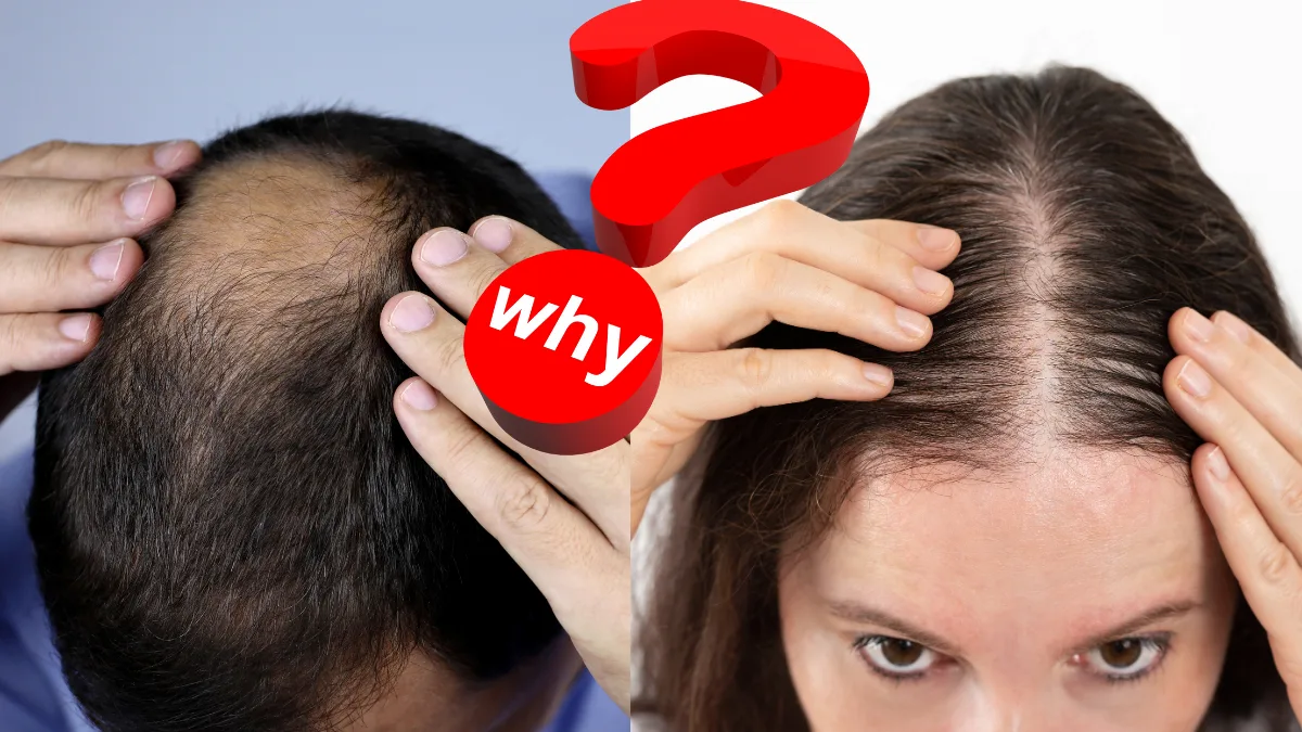 बालों के उपचार का भविष्य-Bharati Fast News